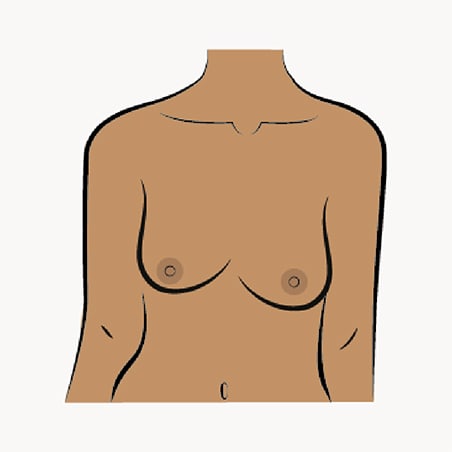 Asymmetric illustration of breasts