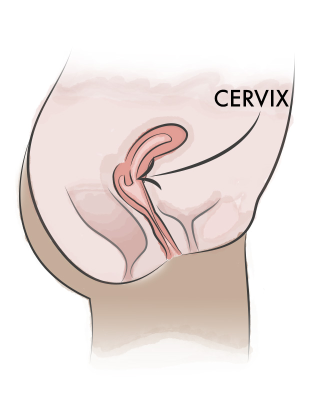 Cervix Illustration