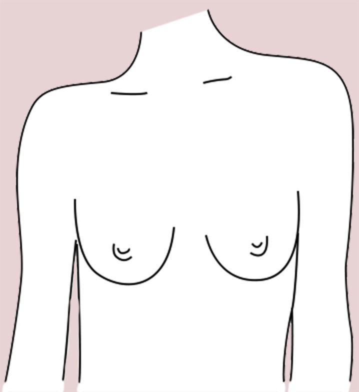 Slender breast shape