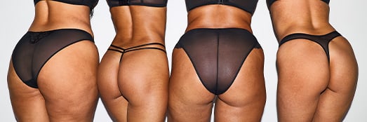 Models wearing Ann Summers Lingerie