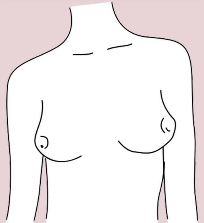 East West breast shape